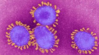 بعدما أصبحت الأكثر تضررا في أوروبا.. ما أسباب انتشار فيروس كورونا في إيطاليا؟