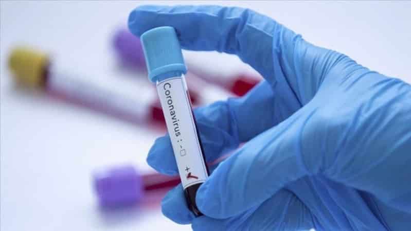 الولايات المتحدة تعلن موعد ظهور علاج فيروس كورونا