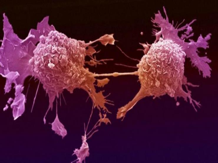 ابتكار مادة تزيد من فعالية العلاج الكيميائي لسرطان الرحم